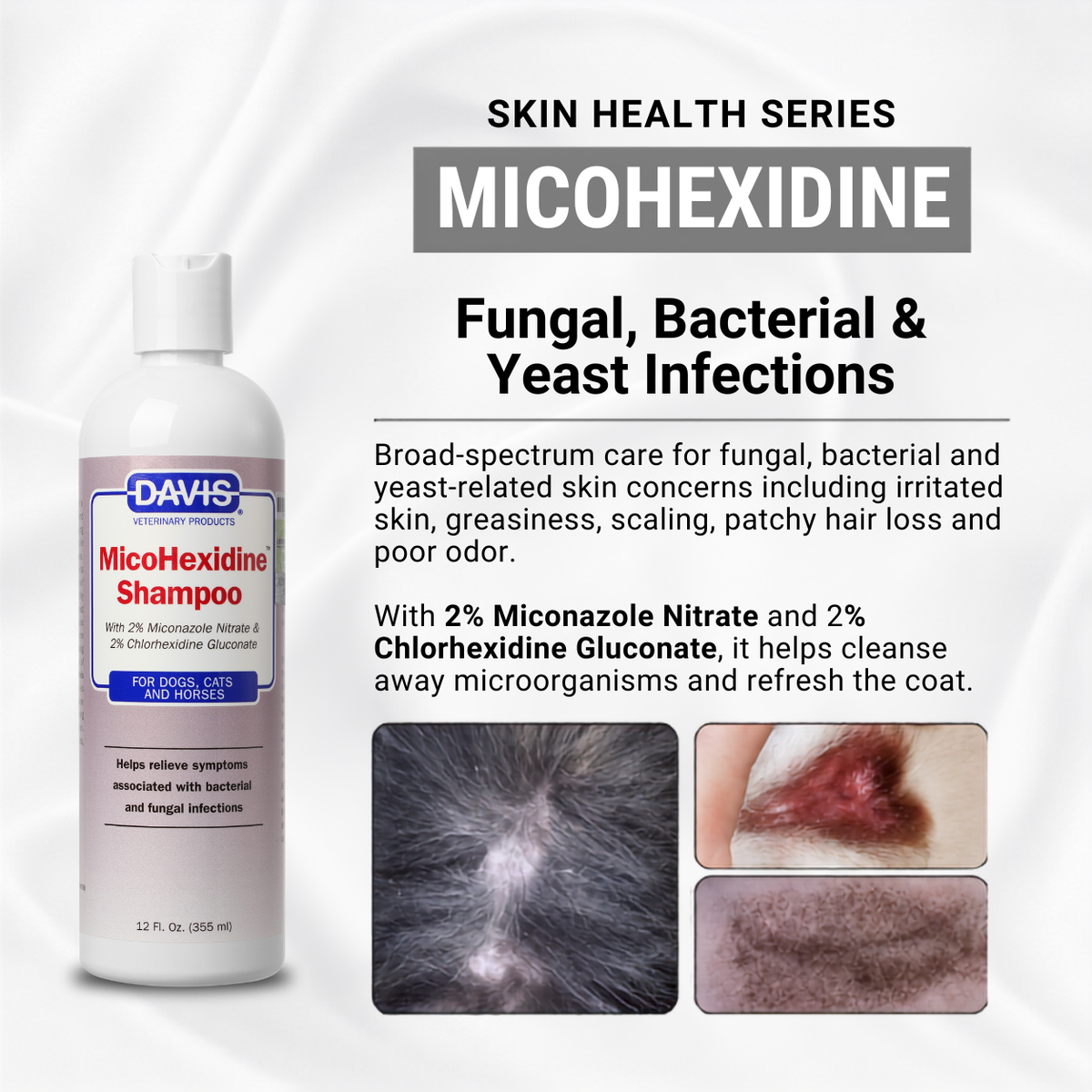 For Skin Infections | Medicated Shampoo Combo