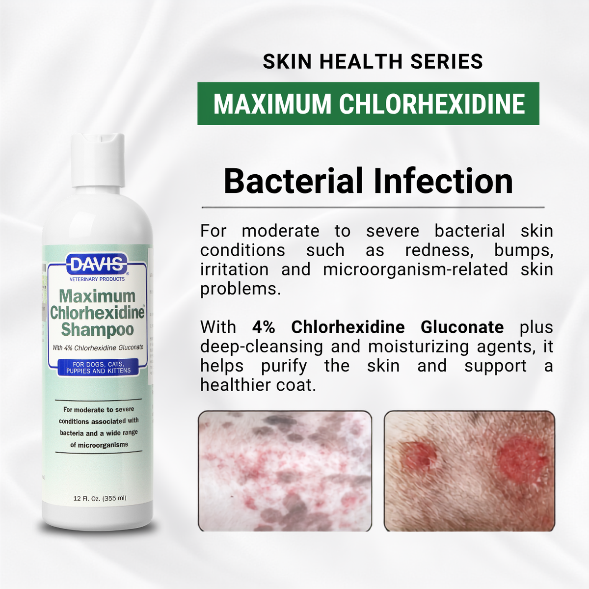 For Skin Infections | Medicated Shampoo Combo