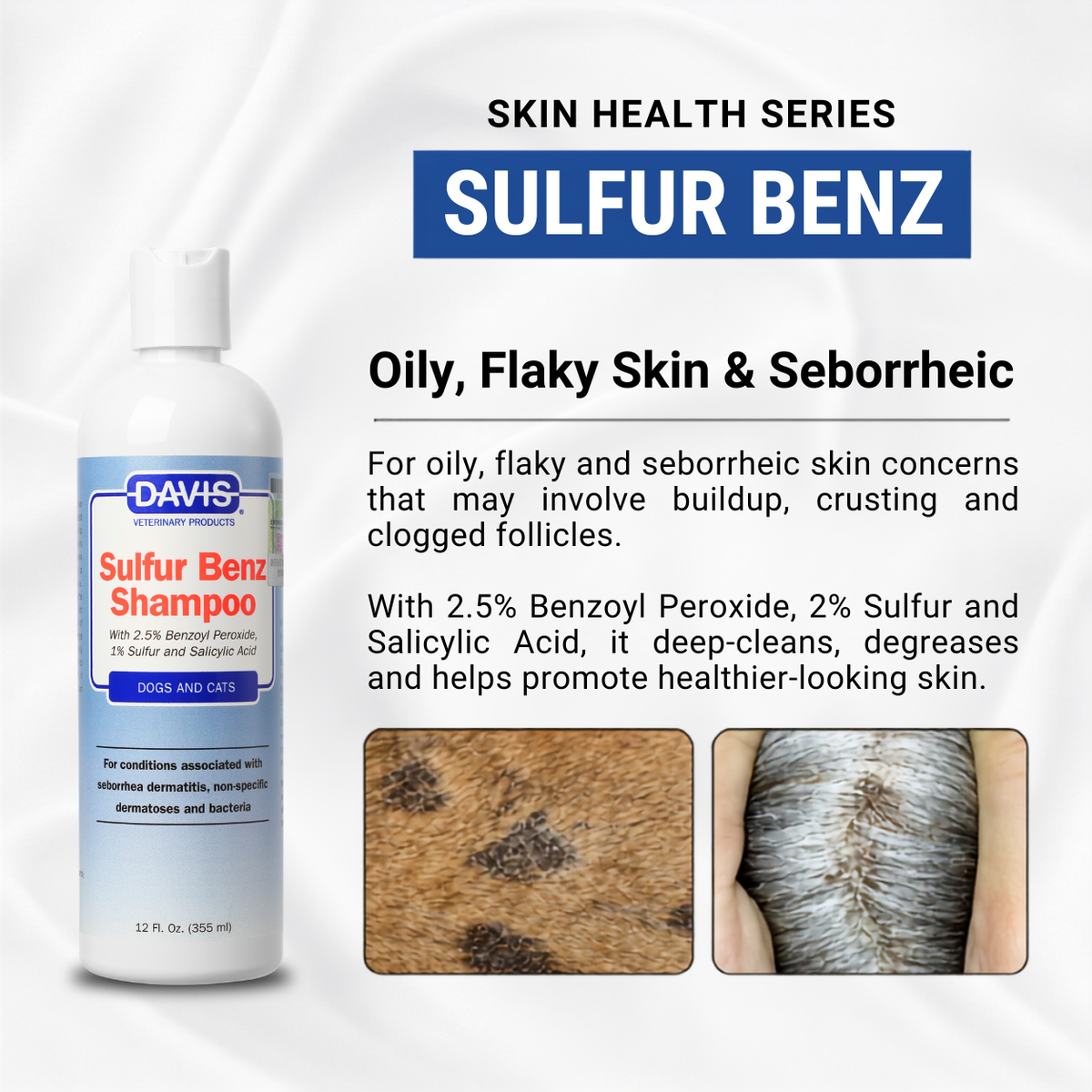 For Skin Infections | Medicated Shampoo Combo