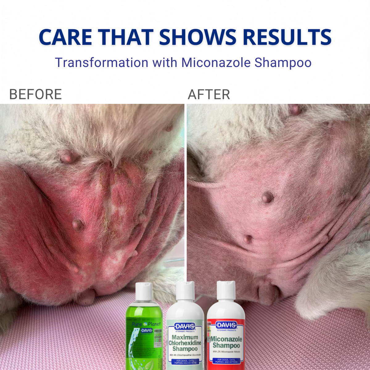 For Skin Infections | Medicated Shampoo Combo